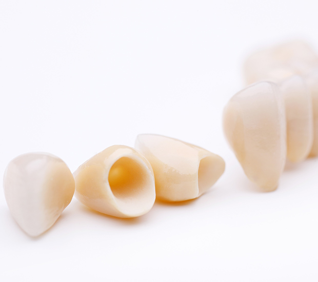 Columbus Dental Crowns and Dental Bridges