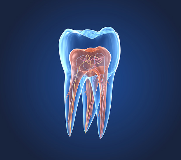 Columbus What is an Endodontist